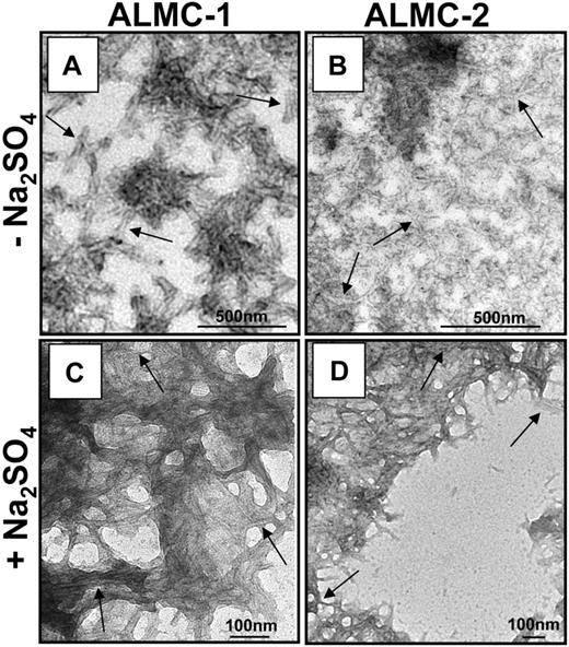 Figure 7. Electron microscopic analysis of fibrils formed from ALMC-1 and ALMC-2 λLC. (A) ALMC-1 λLC. (B) ALMC-2 λLC (diluted 1:10). (C) ALMC-1 λLC in the presence of 0.5 M of Na2SO4 (1:10 dilution). (D) ALMC-2 λLC in the presence of 0.5 of M Na2SO4. Scale bars represent 500 nm for panels A and B and 100 nm for panels C and D. → highlights representative fibrils.
