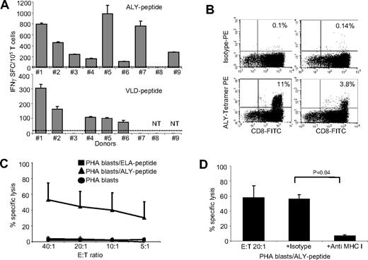 Figure 3. PRAME CTLs can be reproducibly generated from HLA-A*02+ healthy donors. (A) illustrates the frequency of IFNγ + T cells responding to 2 PRAME peptides (ALY and VLD peptides) for PRAME CTL lines generated from 9 HLA-A*02+ healthy donors after 3 stimulations, as assessed by ELIspot assay. PRAME CTLs from donors 1 and 2 also targeted SLL and SLY peptides, respectively (see “Cytokine release”). Fewer than 25 IFNγ+ SFC were counted when CTL lines were pulsed with the ELA-irrelevant peptide (indicated by ----). (B) Staining with the ALY-specific tetramer of 2 PRAME CTL lines generated from healthy donors. (C) PRAME CTLs expanded from healthy donors were evaluated for their cytotoxic activity, using a standard 4-hour 51Cr release assay, against autologous PHA blasts loaded with ALY peptide (▴), ELA-irrelevant peptide (■), or no peptide (●). Data represent the means plus or minus SD of PRAME CTLs from 5 healthy donors. (D) Killing (20:1 E:T ratio) of ALY-loaded autologous PHA blasts by CTLs was significantly inhibited by preincubation of the targets with MHC class I antibody, but not by an isotype control, indicating MHC restricted killing. NT indicates not tested.