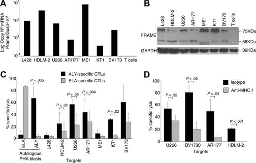 Figure 4. ALY-specific CTLs are cytotoxic to PRAME+ tumor cell lines. (A) Expression of PRAME in several tumor cell lines as assessed by qPCR. (B) Expression of PRAME in the same cell lines by Western blot analysis. In addition to the predicted band (58 kDa), another band of approximately 75kDa was observed, likely originated from posttranscriptional modifications. (C) Cytotoxic activity of ALY-specific CTLs (■) toward tumor cell lines, evaluated using a standard 51Cr release assay. As negative controls, we used (i) CTLs specific for another HLA-A2*02 tumor-restricted epitope (ELA from MART-1 protein; ); (ii) autologous PHA blasts loaded with ELA-irrelevant peptide; (iii) the L428 tumor cell line (PRAME+ but HLA-A*02−). As positive control we used autologous PHA blasts loaded with the ALY peptide. Data at a CTLs:tumor cells ratio of 40:1 are shown. Overall, killing of PRAME+/HLA-A*02+ was significantly higher than control cell killing. (D) Killing of PRAME+/HLA-A*02+ cell lines was inhibited by preincubation with MHC class I antibody but not with isotype control, confirming MHC class I restriction.
