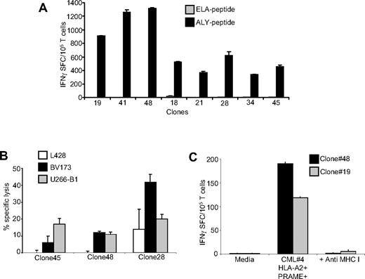 Figure 6. Analysis of clones derived from PRAME CTLs. (A) Specificity of representative single-cell clones targeting the ALY peptide, generated by limiting dilution assay. These representative CTL clones produced significant amounts of IFNγ in response to the ALY peptide but not to ELA-irrelevant peptide. (B) Functional specificity of 3 representative ALY-specific T-cell clones against PRAME+ tumor cell lines. These clones lysed HLA-A*02+/PRAME+ cell lines (BV173, ■ and U266-B1, ) but not the HLA-A*02−/PRAME+ cell line (L428, □). (C) Two representative ALY-specific T-cell clones produce significant amounts of IFNγ in response to blasts isolated from a HLA-A*02+/PRAME+ CML patient (patient 4) in a MHC class I–restricted fashion.