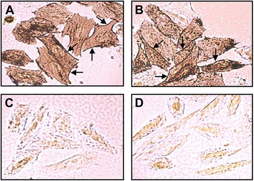 Figure 1. Subcellular localization of the WT and mutant PCFT in stable transfectants. Immunohistochemical analysis of Myc-tagged WT (A) and mutant R113C PCFT (B) was performed with stably transfected RFC-null CHO cells using a Myc-tag–specific monoclonal antibody and 3,3′-diaminobenzidine as a chromogen. No specific immunostaining was observed in mock (C) and untransfected cells (D). Note the similar expression and the intense plasma localization (arrows) of the WT and mutant R113C PCFT.