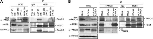 Figure 2. HES1 dependence on the Fanconi anemia pathway. (A) FANCA and FANCG failed to immunoprecipitate with HES1 in FA mutant cells. Normal HSC93 and FA mutant lymphoblasts (FA-C: HSC536; FA-F: EUFA698) were subjected to immunoprecipitation with anti-HES1 antibodies. The immunoprecipitates were analyzed by Western blotting with the indicated antibodies. (B) Cell extracts from HeLa, PD430 (FA-A), and PD430 cells that were complemented with the FANCA gene (FA-A + FANCA) were subjected to immunoprecipitation using anti-FANCG or anti-HES1 antibodies and were immunoblotted with the indicated antibodies.