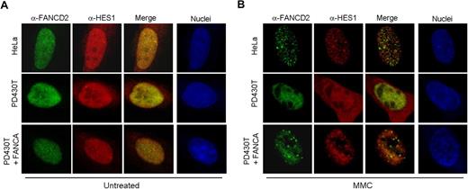 Figure 5. HES1 forms MMC-induced foci. Localization of endogenous HES1 in HeLa, PD430T (FA-A), and PD430T complemented with the FANCA gene. Cells were double stained with anti-HES1 and anti-FANCD2 antibodies at 0 (A: untreated) or 4 (B) hours following treatment with MMC (50 ng/mL) and processed for immunofluorescence. Nuclei were labeled with TOPRO-3.