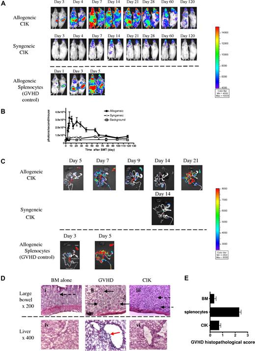 Figure 2. Trafficking and survival of CIK cells upon adoptive transfer. Lethally irradiated host allogeneic (Balb/c, H-2d, n = 5) and syngeneic (FVB/N, H-2q, n = 5) recipients were injected with 5 × 106 FVB wild-type BM cells with 10 × 106 CIK cells generated from luc+ FVB mice (L2G85). To compare GVHD development, 10 × 106 L2G85 splenocytes were transplanted with BM cells (n = 5). (A) BLI of mice after transplantation. Donor-derived CIK cells in the allogeneic mice homed to and proliferated in secondary lymphoid organs, followed by the infiltration of gut and skin (top row), which was similar to GVHD progression (bottom row). However, in CIK cell–receiving mice, the speed of spread to peripheral tissue was slower and maximum peak signal from gut was lower than that in animals receiving fresh splenocytes. In syngeneic mice (middle row), there was no significant CIK cell proliferation and only a transient signal was observed on day 14 in cervical lymph nodes and abdomen. (B) Quantitation of photon emission of BLI. (C) Ex vivo imaging demonstrated compared with naive splenocytes, CIK cell homing to and proliferating in gastrointestinal tissues over time. (D) Histopathology of selected tissues on day 7 after transplantation. Magnification was ×200 or ×400 as indicated. Goblet cells (dashed arrow); crypt abscesses (solid arrow); lymphocytic infiltration surrounding the bile ducts (red arrow). (E) Mice receiving splenocytes (n = 3) or CIK cells (n = 3) were humanely killed on day 7 after BMT. GVHD histopathologic score was calculated on liver, small intestine, and large intestine damage on day 7 after BMT (CIK vs splenocytes, P = .002). Error bars represent SD.