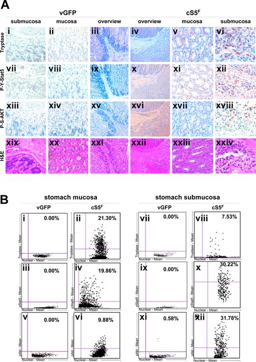 Figure 1. Constitutive activation of Stat5 induces mast cell hyperplasia and leukemic cell infiltrates in the gastrointestinal tract of cS5F mice. (A) Immunohistochemical analysis of stomach walls of mice that underwent transplantation with cS5F BM cells versus control mice that received GFPv BM cells (n > 6 mice analyzed in each group and a representative example is shown). To detect neoplastic MCs, sections of the stomach mucosa and submucosa of CS5F mice and control GFPv-mice were immunostained with an antitryptase antibody (i-vi). The presence of tyrosine694/695 phosphorylated Stat5 (P-Y-Stat5; vii-xii) and serine473 phosphorylated Akt (P-S-Akt; xiii-xviii) was analyzed with specific antibodies on consecutive tissue sections (original magnification, ×400). An overview of each staining on consecutive sections is shown in the 2 panels labeled “Overview” (iii, iv, viiix, xv, xvi, xxi, xxii) for leukemia cS5F and control GFPv mice (original magnifications, ×25 and ×100, respectively). H&E staining is shown for organotypic structure comparison (xviiii-xxiv). (B) Quantification of P-Y-Stat5, tryptase, and P-S-Akt stainings was performed on consecutive sections using HistoQuest analysis software (results shown in the scattergram plots are the mean of 4 fields of view for each staining). The cutoff values for background staining were chosen manually using the forward/backward gating tool of the HistoQuest software.