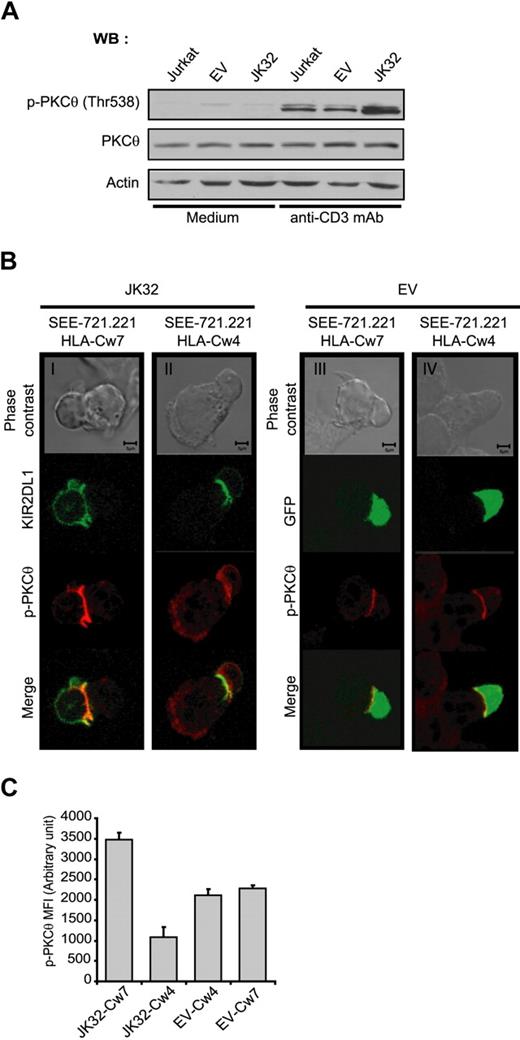 Figure 6. Involvement of PKC-θ in the costimulatory effect of KIR2DL1 in human T cells. (A) Jurkat, EV, and JK32 cells were stimulated with mAb for 15 minutes. Cell lysates were analyzed by immunoblotting with mAbs against p-PKC-θ, PKC-θ, and actin. (B) Confocal microscopic analysis of the distribution of p-PKC-θ and KIR2DL1 in EV and JK32 cells conjugated with SEE-pulsed 721.221/HLA-Cw7 or 721.221/HLA-Cw4 cells. The distribution of p-PKC-θ (in red) was analyzed as in Figure 4. KIR2DL1 appears as green fluorescence. (C) Cells were treated as described in panel B, and images of 5 fields were visualized with a 63×/1.4 oil-immersion objective. Signal intensity was quantified with ImageJ software.