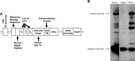 Figure 2. Expression of the CD20-specific cTCR. (A) Schematic diagram of the CD20-specific scFvFc:ζ chimeric T-cell receptor cDNA plasmid. (B) A representative Western blot analysis of cTCR expression performed using whole-cell lysates of preinfusion T cells from patient B, probed with mouse anti–human CD3ζ monoclonal Ab. Negative control was parental PBMCs, and positive control was transfected Jurkat cell line. A 21-kDa band corresponding to the endogenous CD3ζ chain and a 66-kDa band representing the expected cTCR protein were detected. The intermediate bands indicate degradation products or truncated forms of the cTCR.