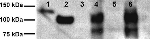 Figure 1. Isolation of sCD22. Shown are Western blots of recombinant purified sCD22-Fc (lane 1), sCD22 (lane 2), serum from a healthy donor (lane 3), serum from an HCL patient (lane 4), culture medium (land 5), and culture medium from the HCL Eskol cell line (lane 6).