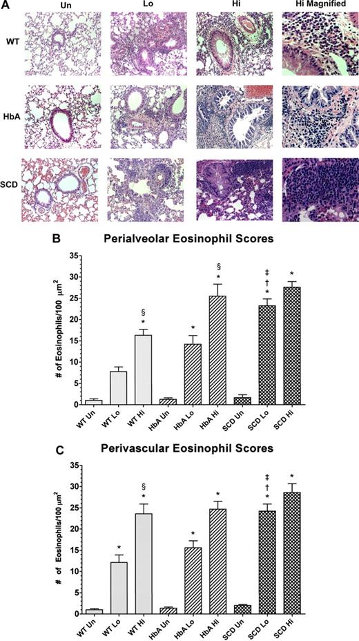 Figure 5. Histology of lungs from unsensitized and sensitized WT, HbA, and SCD mice. (A) This figure shows images of H&E staining of lungs from UnSen, LoSen, and HiSen WT, HbA, and SCD mice. First row: Images of lung sections from UnSen (Un), LoSen (Lo), and HiSen (Hi) WT mice. Second row: Images of lung sections from UnSen (Un), LoSen (Lo), and HiSen (Hi) HbA mice. Third row: Images of lung sections from UnSen (Un), LoSen (Lo), and HiSen (Hi) SCD mice. Eosinophil counts in the (B) peribronchial and (C) perivascular regions of the lungs from UnSen, LoSen, and HiSen WT, HbA, and SCD mice. Statistical analysis: * indicates significantly different from UnSen group within same strain; §, significantly different from LoSen (Lo) group within same strain; †, significantly different from wild-type (WT) group with same treatment; and ‡, significantly different from the HbA groups with same treatment. (P < .05, adjusted for the number of comparisons.)