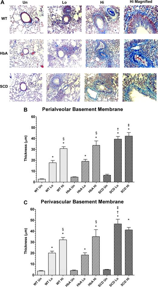 Figure 6. Collagen deposition in lungs from unsensitized and sensitized WT, HbA, and SCD mice. (A) This figure shows images of McLetchie trichrome staining of lungs from UnSen, LoSen, and HiSen WT, HbA, and SCD mice. First row: Images of lung sections from UnSen (Un), LoSen (Lo), and HiSen (Hi) WT mice. Second row: Images of lung sections from UnSen (Un), LoSen (Lo), and HiSen (Hi) HbA mice. Third row: Images of lung sections from UnSen (Un), LoSen (Lo), and HiSen (Hi) SCD mice. Basement membrane thickening in the (B) peribronchial and (C) perivascular regions of the lungs from UnSen, LoSen, and HiSen WT, HbA, and SCD mice. Statistical analysis: * indicates significantly different from UnSen group within same strain; §, significantly different from LoSen (Lo) group within same strain; †, significantly different from wild-type (WT) group with same treatment; and ‡, significantly different from the HbA groups with same treatment. (P < .05, adjusted for the number of comparisons.)
