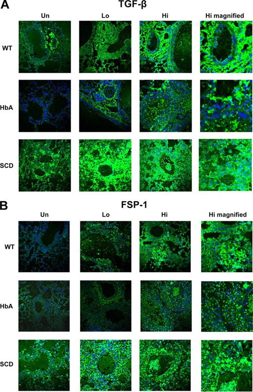 Figure 7. TGFβ and fsp-1 expression in lungs from UnSen and Sen WT, HbA, and SCD mice. This figure shows images of (A) immunofluorescence of TGFβ1 and (B) immunofluorescence of fsp-1 in lungs of UnSen, LoSen, and HiSen WT, HbA, and SCD mice. First row: Images of lung sections from UnSen (Un), LoSen (Lo), and HiSen (Hi) WT mice. Second row: Images of lung sections from UnSen (Un), LoSen (Lo), and HiSen (Hi) HbA mice. Third row: Images of lung sections from UnSen (Un), LoSen (Lo), and HiSen (Hi) SCD mice. Magnification: 40× for all frames except high magnified (100×).