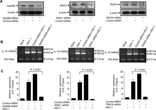 Figure 1. MyD88, IRAK1, and TRAF6 are involved in HSV-1–induced IL-15 up-regulation in THP1 cells. (A) THP1 cells were transfected with either adaptor-specific siRNAs or control siRNA. Cells were harvested 48 hours later, and protein lysates were analyzed for MyD88, IRAK1, TRAF6, and β-actin expression by immunoblotting. Representative Western blots are shown. (B) Wild-type THP1 cells as well as MyD88-, IRAK1-, or TRAF6-deficient cells were incubated with mock or HSV-1. Cells were harvested 6 hours after treatment for total RNA extraction, and IL-15 gene expression was examined by RT-PCR. The PCR products were 550 and 640 bp for IL-15 (representing the 2 isoforms) and 310 bp for the internal control 18S rRNA and are representative of 3 independent experiments. (C) Total RNA was also used to determine IL-15 gene expression by real-time RT-PCR. Data are expressed as the ratio of IL-15 mRNA in treated samples to the untreated sample (after normalization with reference dye and housekeeping gene).
