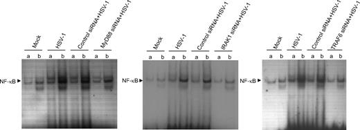 Figure 2. MyD88, IRAK-1, and TRAF6 are required for HSV-1–induced NF-κB leading to IL-15 gene expression. Wild-type THP1 cells or MyD88-, IRAK1-, TRAF6-deficient cells were treated with mock or HSV-1. After 1 hour of incubation, cells were collected and nuclear extracts were subjected to EMSA analysis with radiolabeled NF-κB consensus oligonucleotide in the presence of unlabeled competitor (a lanes) or nonspecific competitor (b lanes). NF-κB binding was visible by autoradiography.