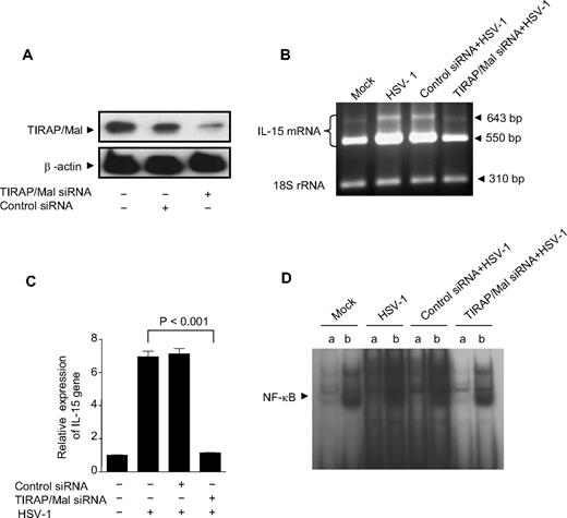 Figure 5. TIRAP/Mal is required in HSV-1–induced up-regulation of IL-15 gene expression. (A) THP-1 cells were transfected with TIRAP/Mal siRNA or control siRNA for a total period of 48 hours, and protein lysates were analyzed for TIRAP and β-actin expression levels by immunoblotting. (B) TIRAP/Mal-deficient THP-1 cells were treated with HSV-1, and IL-15 gene expression was determined by RT-PCR. IL-15 mRNA (top panel) and 18S rRNA (bottom panel) are shown and are representative of 3 independent experiments. (C) IL-15 gene expression was also analyzed by real-time RT-PCR. Data are expressed as the ratio of IL-15 mRNA in treated samples to the untreated sample (after normalization with reference dye and housekeeping gene). (D) TIRAP/Mal-deficient THP1 cells were incubated with HSV-1 for 1 hour. Nuclear extracts were subjected to EMSA analysis with radiolabeled NF-κB consensus oligonucleotide in the presence of unlabeled competitor (a lanes) or nonspecific competitor (b lanes). NF-κB binding was visible by autoradiography.