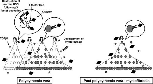 Figure 5. Putative model of evolution from PV toward post-PV myelofibrosis, through modification of the HSC compartment. The left diagram shows a model of hematopoiesis from the HSCs to mature cells in PV. JAK2V617F cells are in gray, and JAK2WT cells in white. The properties of JAK2V617F HSCs are not modified, compared with JAK2 WT HSC, either in term of self-renewal or proliferation. However, a major amplification of terminal myeloid differentiation is observed, from the stage of differentiation when progenitors express homodimeric type I cytokine receptors. We hypothesize that JAK2V617F cells would produce TGF-β1, responsible for the progressive development of myelofibrosis, and another cytokine or chemokine (X-factor) responsible for the progressive destruction of normal hematopoiesis, that could also be TGF-β1. As JAK2WT HSCs would express the receptors of X-factor, they would be sensitive to X-factor–negative regulatory signals and therefore progressively destructed. On the contrary, JAK2V617F HSCs would have a decreased expression of X-factor receptor or signaling and would express antiapoptotic proteins, such as bcl-xl, being therefore insensitive to apoptosis. The right panel shows the stage of post-PV myelofibrosis, when the increasing and persistent production of TGF-β1 would induce myelofibrosis and when JAK2WT HSCs have been destructed following X-factor stimulation. The only remaining HSCs are thus JAK2V617F, without any increase in self-renewing properties.