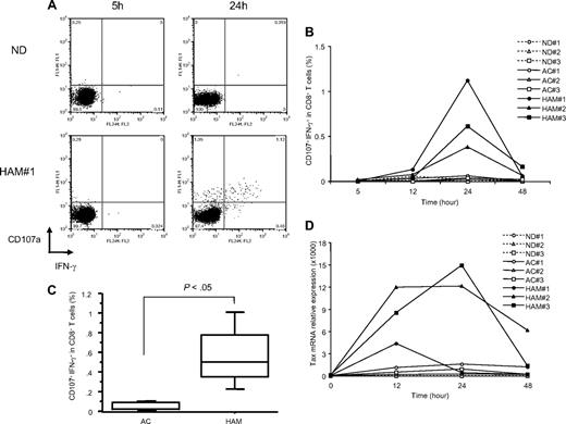 Figure 1. Spontaneous degranulation and IFN-γ production in CD8+ T cells of HAM/TSP patients. (A) Flow cytometric analysis of CD107a/IFN-γ expression in CD8+ T cells of an ND and a representative HAM/TSP patient (HAM#1) after culture for 5 and 24 hours. Cells were cultured in the absence of any additional stimulators. (B) Time course of CD107a/IFN-γ expression in CD8+ T cells of NDs (ND#1-3) and HTLV-I–infected patients (AC#1-3 and HAM#1-3). PBMCs were cultured for 5 to 48 hours, and analyzed by flow cytometry at each time point. (C) Comparison of CD107a/IFN-γ expression in CD8+ T cells of HTLV-I–infected patients at 24 hours culture. The data were obtained from 5 ACs and 9 patients with HAM/TSP. The horizontal line represents the median, the box represents the 25th percentile, and the whiskers represent the 75th percentile. (D) Time course of Tax mRNA expression in NDs (ND#1-3) and HTLV-I–infected patients (AC#1-3 and HAM#1-3). This experiment was performed at the same time points as with Figure 1B, and total RNAs were isolated from cultured cells at each time point.