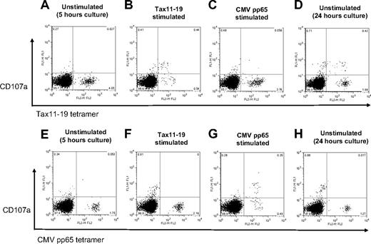 Figure 3. Antigen-specific degranulation in CD8+ T cells from a HAM/TSP patient. PBMCs of a HAM/TSP patient (HAM#5) were cultured without any stimulation (A,E) or with Tax11-19 peptides (B,F) or CMVpp65 peptides (C,G) for 5 hours. Top or bottom panels show the detection of CD107a with Tax11-19 tetramer and CMV pp65 tetramer staining, respectively. Panels D and H show the results of spontaneous degranulation in CD8+ T cells of unstimulated culture for 24 hours.