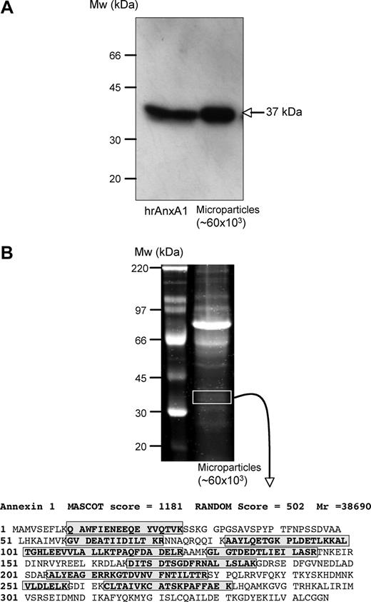 Figure 1. Identification of annexin 1 in human PMN–derived microparticles. Use of multiple detection approaches revealed annexin 1 (AnxA1; 37 kDa) presence in PMN-derived microparticles. (A) Western blot analysis comparing human recombinant AnxA1 (0.1 ng) and extracts from approximately 60 × 103 microparticles; arrow indicates AnxA1 band. (B) Protein gel electrophoresis revealing multiple bands in PMN-derived microparticles. Bands in the approximately 37-kDa region were excised, digested, and subjected to LC/MS/MS where both the MASCOT scores and the RANDOM database scores confirm the presence of this protein; boxed amino acid sequences indicate the fragments identified from this analysis. Data are representative of 4 distinct analyses.