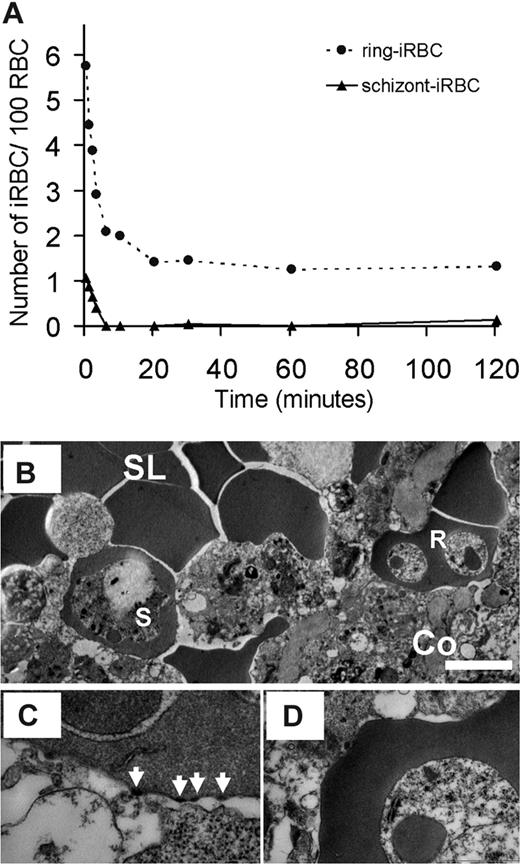 Figure 3. Clearance of iRBCs by the isolated-perfused human spleen. (A) Parasitemia of P falciparum FUP schizont-iRBCs (▲) and ring-iRBCs (●) in the perfusate during 120 minutes of perfusion in 1 of 6 independent experiments with isolated-perfused human spleens (all 6 experiments shown in Figure S1, a1-6). (B) Transmission electron microscopy of an end-experiment spleen sample showing a schizont-iRBC (S). (B,C) Bar represents 1 with knobs (C, arrows) in the lumen of a sinus (B, SL) of the red pulp, and a knobless ring-iRBC (B-D, R), in the cords (B, Co). Another example of retained ring-iRBC is shown in Figure 4H,I.