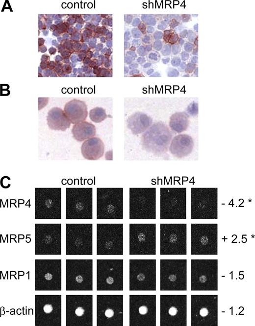 Figure 4. shMRP4 down-regulates MRP4 protein and mRNA expression. MRP4 protein expression analyzed by immunocytochemistry in HEK-MRP4 cells transduced with pRetroSUPER.puro.vector (A, left; control) or pRetroSUPER.shMRP4.puro (A, right) or LC cultures from MUTZ3 stably transfected with pRetroSUPER.GFP.vector (B, left; control), or pRetroSUPER.GFP.shMRP4 (B, right). Original magnification, 100×. (C) Triplicate MRP4 mRNA levels measured by low-density array in MUTZ3-vector control (left) or MUTZ3-shMRP4 cells (right). Numbers indicate the fold increase (+) or decrease (−) with respect to MUTZ3-vector control levels (*P < .05).
