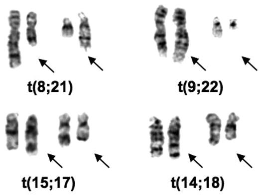 Figure 1. Partial karyotypes of common translocations discovered by Rowley. The translocations appear in the order in which they were discovered.