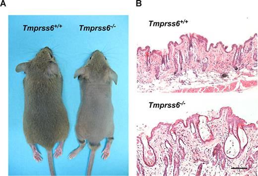 Figure 2. Alopecia phenotype in Tmprss6−/− mice. (A) Representative photographs of 4-week-old Tmprss6+/+ and Tmprss6−/− littermate mice. (B) Skin sections from 4-week-old wild-type and Tmprss6−/− mice showing dystrophic hair follicles and hyperkeratosis in Tmprss6-null tissue, compared with the wild-type. Bar represents 100 μm; magnification, 20×/0.40 NA.