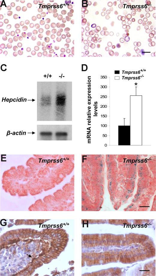 Figure 3. Hepcidin up-regulation reduces ferroportin expression and causes an anemic phenotype in Tmprss6−/− mice. Wright-Giemsa–stained blood smears from Tmprss6+/+ (A) and Tmprss6−/− (B) littermate mice. The figure shows the severe hypochromia found in mutant erythrocytes in comparison to wild-type ones. (C) Representative Northern blot analysis of liver tissues from wild-type and Tmprss6−/− mice showing the increased hepcidin mRNA expression in mutant mice. (D) TaqMan real-time PCR analysis of hepcidin expression in liver samples from 7-week-old Tmprss6+/+ and Tmprss6−/− mice. mRNA levels on the y-axis are expressed relative to β-actin levels. The average relative expression of hepcidin in wild-type mice was assigned an arbitrary value of 100. Values are means (± SEM). *P < .05; n = 5 mice per group. Perls Prussian blue stain for iron in sections of duodenal villi of 5-week-old Tmprss6+/+ (E) and Tmprss6−/− (F) mice shows iron accumulation in Tmprss6-null enterocytes. Representative immunostaining of ferroportin in duodenal tissue from 5-week-old Tmprss6+/+ (G) and Tmprss6−/− (H) mice. Arrow points to the basal expression of ferroportin in wild-type enterocytes, whereas positive basal staining is absent in Tmprss6-null cells. Bars represent 10 μm, magnification 100×/1.25 NA (A,B); bars 20 μm, magnification 60×/0.80 NA (E-H).