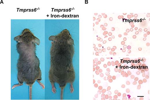 Figure 4. Iron-dextran therapy rescues the Tmprss6−/− phenotype. (A) Representative photograph of a 2-month-old Tmprss6−/− mice before (left) and after 1 month of iron-dextran treatment (right). (B) Wright-Giemsa–stained blood smears from untreated (top) and iron-dextran injected (bottom) Tmprss6−/− mice. Bar represents 10 μm; magnification, 100×/1.25 NA.