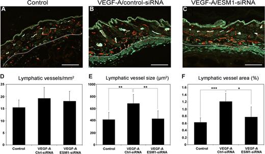 Figure 4. Targeting ESM-1 by siRNA inhibits VEGF-A effects on lymphatic vessels in vivo. Differential immunostains for CD31 (red) and LYVE-1 (green) reveal that, compared with Matrigels that contain PBS (control) (A), LYVE-1+ lymphatic vessels (green) surrounding Matrigels containing VEGF-A and control siRNA were enlarged (B). Lymphatic vessels were not enlarged surrounding Matrigels containing VEGF-A and ESM-1 siRNA (C). Scale bars equal 100 μm. Computer-assisted morphometric analyses of LYVE-1/CD31–stained sections showed comparable density of lymphatic vessels in all groups (D). The mean size of lymphatic vessels was significantly larger surrounding Matrigels containing VEGF-A and control siRNA (Ctrl-siRNA) than Matrigels containing PBS (control) (E) or VEGF-A and ESM-1 siRNA (ESM1-siRNA). The mean tissue area covered by lymphatic vessels was significantly increased surrounding VEGF-A/Ctrl-siRNA implants compared with PBS-containing (control) or VEGF-A/ESM1-siRNA–containing implants (F). *P < .05; **P < .005; ***P < .001.