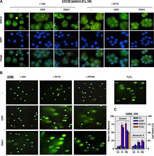 Figure 2. Cotreatment with R115777 and Chk1 inhibitors induces a pronounced increase in γH2A.X foci formation and DNA breaks. (A) Primary CD138+ cells were isolated from the bone marrow of a patient (no. 1) with MM. Cells were then either untreated or exposed (16 hours) to 150 nM UCN-01 (UCN) or 2 μM Chk1i in the absence or the presence of 5 μM R115777 (R115). After treatment, cells were harvested and stained with Alexa Fluor (AF) 488–conjugated phospho-H2A.X (Ser139) antibody for immunocytochemical analysis. Images were captured at 60×/1.40 oil. (B) U266 cells were treated with 150 nM UCN-01 or 2 μM Chk1i with or without 5 μM R115777 or 5 μM PD184352 for 24 hours, after which a comet assay was performed to assess DNA breaks. As control, U266 cells were treated with 100 μM hydrogen peroxide for 20 minutes. (C) Tail moment was calculated as the percentage of DNA in the tail and the distance between the means of head and tail distributions. Mean tail moment was determined by measuring at least 100 cells per sample. Results represent the means plus or minus SD for 3 separate experiments. In parallel, the percentage of annexin V+ cells was determined by flow cytometry. V indicates vehicle. Results represent the means plus or minus SD for 3 separate experiments performed in triplicate.