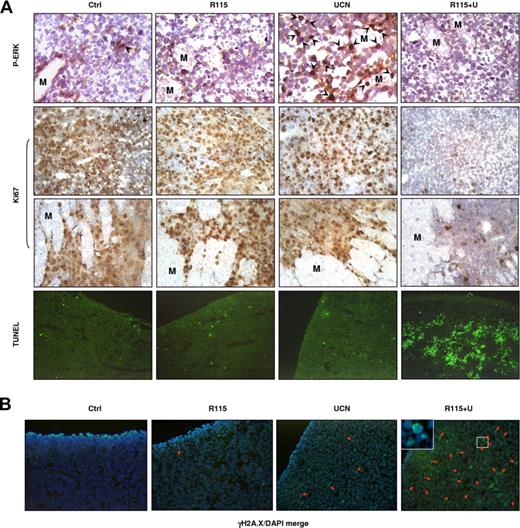 Figure 7. R115777 diminishes UCN-01–induced ERK1/2 activation in association with an increase in γH2A.X expression/foci formation and a dramatic induction of apoptosis induced by UCN-01 in vivo. (A) Following the experiments described in Figure 6, tumors were excised after the final dose, and subjected to immunohistochemistry for ERK1/2 phosphorylation and Ki67 expression, as well as TUNEL staining. indicates nuclear staining of phospho-ERK1/2 in tumor cells. M indicates muscle. (B) Alternatively, tumor tissue sections were stained with Alexa Fluor 488–conjugated γH2A.X antibodies to monitor γH2A.X expression and nuclear foci formation. Arrows indicate cells with γH2A.X foci. Results are representative of 3 separate sets of tumor sections.