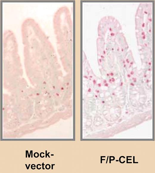 Infiltration of mast cells in the small intestine of FIP1L1/PDGER α expressing mice versus FN “AND” replaced with “vs.” control mice. See the complete figure in the article beginning on page 2500.