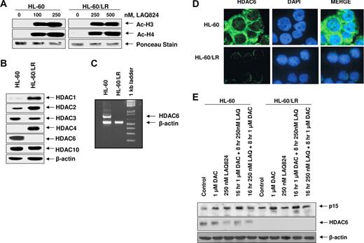 Figure 4. Compared with HL-60, HL-60/LR cells lack HDAC6 expression and LAQ824 induces acetylation of histones H3 and H4 in both HL-60 as well as HL-60/LR cells. (A) After treatment of HL-60 and HL-60/LR cells with the indicated concentrations of LAQ824 for 24 hours, histones were isolated and immunoblot analyses of acetylated histones H3 and H4 were performed. Ponceau staining was used to compare equal protein loading in each lane. (B) Total cell lysates from HL-60 and HL-60/LR cells were used to perform Western blot analyses with specific antibodies against HDAC1, HDAC2, HDAC3, HDAC4, HDAC6, HDAC10, and acetylated α-tubulin. The levels of β-actin served as the loading control. (C) Total RNA from HL-60 and HL-60/LR cells was analyzed by reverse-transcription (RT)–PCR using HDAC6 and β-actin primers. (D) HL-60 and HL-60/LR were fixed on slides, stained with FITC-conjugated anti-HDAC6 antibody (green) and/or DAPI (blue), and imaged with a Zeiss LSM510 confocal microscope with a 63×/1.2 NA water-immersion objective lens. (E) HL-60 and HL-60/LR cells were treated with decitabine and/or LAQ824 as indicated. Then, immunoblot analyses were done for p15 and HDAC6 on the total cell lysates. The levels of β-actin in the lysates served as the loading control.