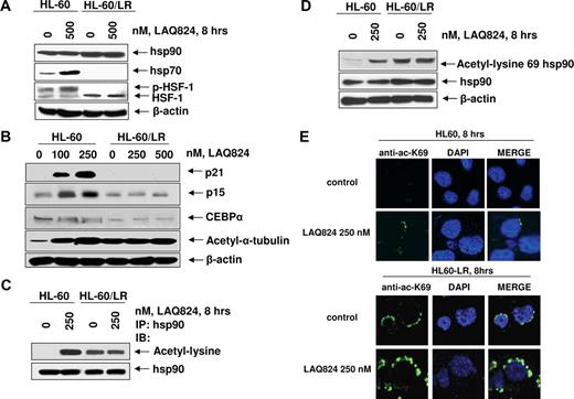 Figure 5. Compared with HL-60, HL-60/LR cells lack p-HSF1 and hsp70, and LAQ824 treatment did not increase acetylation of hsp90 or induce p21 levels in HL-60/LR cells. (A) HL-60 and HL-60/LR cells were treated with the indicated concentrations of LAQ824 for 8 hours. After this, Western blot analyses were done for hsp70, hsp90, and HSF-1. (B) HL-60 and HL-60/LR cells were treated with the indicated concentrations of LAQ824 for 24 hours. Then total cell lysates were harvested and immunoblot analyses were done for p21, p15, CEBPα, and acetylated α-tubulin. The levels of β-actin expression in the lysates served as the loading control. (C) After treatment with the indicated concentrations of LAQ824, immunoprecipitates of hsp90 were immunoblotted with anti–acetyl lysine or anti-hsp90 antibody. (D) HL-60 and HL-60/LR cells were treated with 250 nM LAQ824 for 8 hours. Then, cell lysates were harvested and immunoblot analyses were done with anti–acetylated lysine 69 hsp90 or anti-hsp90 antibody. The levels of β-actin in the lysates served as the loading control. (E) HL-60 and HL-60/LR cells were treated with 250 nM LAQ824 for 8 hours. Then, cells were cytospun and fixed on slides, and stained with FITC-conjugated anti-acetylated lysine 69 hsp90 antibody (green) and/or DAPI (blue), and imaged with a Zeiss LSM510 confocal microscope with a 63×/1.2 NA water-immersion objective lens.