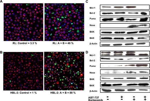 Figure 5. Enhanced apoptosis of ABT-737 combined to bortezomib in DLBCL (RL) and MCL (HBL-2) and effect on Bcl-2 family of proteins. (A,B) The combination induces significant apoptosis as shown by confocal microscopy, in RL (DLBCL, panel A) and HBL-2 (MCL, panel B) after 24 hours. ABT-737 (A) + bortezomib (B) showed statistically significant more apoptosis compared to any other treatment group (P .001). Mitotacker is red (mitochondria of live cells), Hoechst 33342 is blue (nuclei), and Yo-pro-1 is green (apoptotic cells). (C,D) Bcl-2, Mcl-1, BAX, BAK, Puma, and Noxa expression before and after treatment with ABT-737 at 100 nM (C, RL) or 10 nM (D, HBL-2) and bortezomib at 10 nM (RL) or 6 nM (HBL-2) was analyzed by Western blot. β-Actin was used to normalize protein loading.