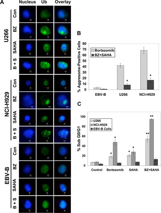 Figure 2. SAHA disrupts bortezomib-induced aggresome formation and augments BZ-induced apoptosis. (A) Multiple myeloma cells form large aggresomes that are disrupted by SAHA. Cells were treated with 5 nM BZ, 2 μM SAHA, or both agents. Cells were then cytocentrifuged onto glass slides, fixed, and stained as described in “Confocal microscopy.” Images were obtained by confocal microscopy. Magnification = 40 ×. (B) Quantification of aggresome formation. Cells were either untreated or treated with SAHA, BZ, or the combination. Aggresomes were present only in cells treated with BZ or BZ + SAHA. Approximately 200 cells were counted and scored as aggresome positive or negative. Mean (n = 3), SD. * indicates a significant difference from values obtained for bortezomib treatment, P < .05. (C) EBV-immortalized B cells are unaffected by the bortezomib and SAHA combination. Cells were treated with 5 nM BZ, 2 μM SAHA, or both agents for 24 hours, and apoptosis was measured by PI-FACS analysis. Mean (n = 3), SD. * indicates a significant difference from control and ** represents a significant difference from single-agent treatments, P < .05.