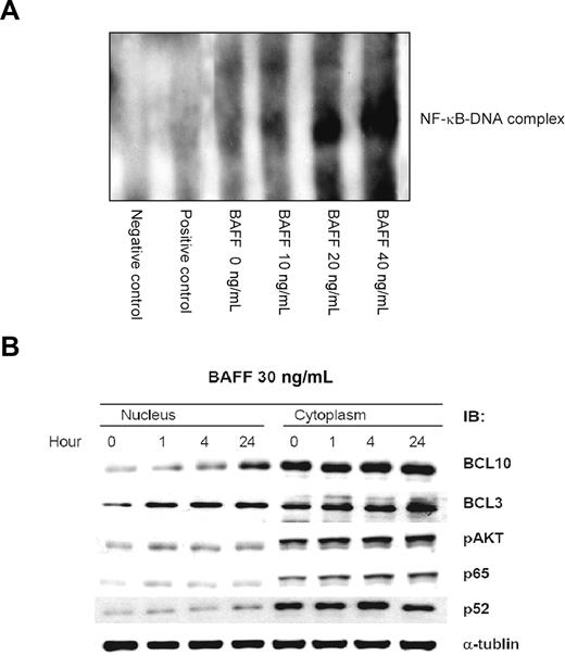 Figure 2. BAFF induces NF-κB activation and results in up-regulation and nuclear translocation of BCL10. (A) BAFF induces NF-κB DNA-binding activity. Pfeiffer cells were treated with BAFF at the indicated concentration. The NF-κB DNA-binding activity was determined by the LightShift chemiluminescent EMSA kit. (B) BAFF induces a time course–dependent pAKT expression and nuclear translocation of BCL10 and BCL3. After BAFF (20 ng/mL) treatment, the protein level of pAKT, BCL10, and BCL3 of Pfeiffer lymphoma cells was determined by immunoblotting (IB). Staining with NF-κB p65, NF-κB p52, and α-tubulin served as loading control.
