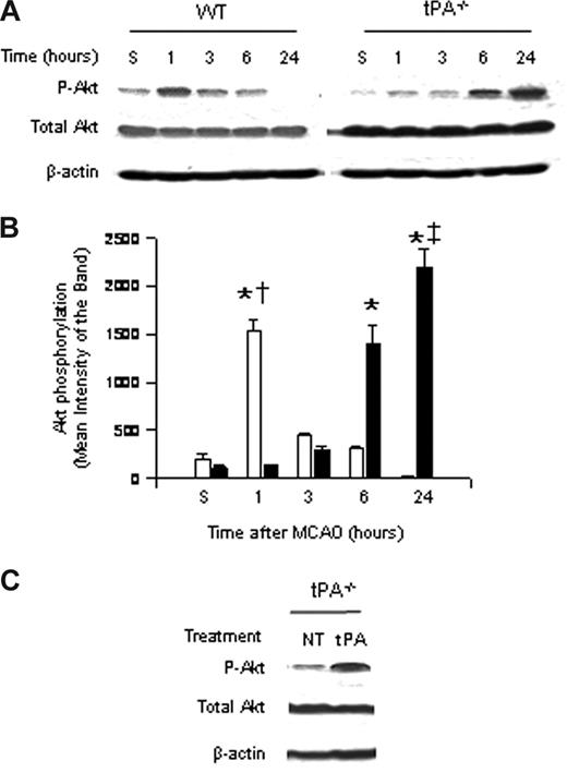 Figure 1. Effect of tPA deficiency on Akt phosphorylation in the ischemic brain. (A) Representative Western blot analysis for Akt phosphorylated at serine 473 (pAkt) and total Akt in brain extracts from wild-type (WT) and tPA-deficient (tPA−/−) mice 1 to 24 hours after middle cerebral artery occlusion (MCAO). S denotes sham-operated mice. (B) Mean density of the band of 6 immunoblots for pAkt in wild-type (□) and tPA−/− mice (■) 1 to 24 hours after MCAO. n = 6. Lines depict SD. *P < .001 relative to either WT or tPA−/− sham-operated mice. †P < .001 compared with tPA−/− mice 1 hour after MCAO. ‡P < .001 relative to WT mice 24 hours after MCAO. (C) Representative Western blot analysis for pAkt in brain extracts from tPA−/− mice 1 hour after middle cerebral artery occlusion (MCAO) and either no treatment (NT) or the intracerebral injection of tPA (tPA).