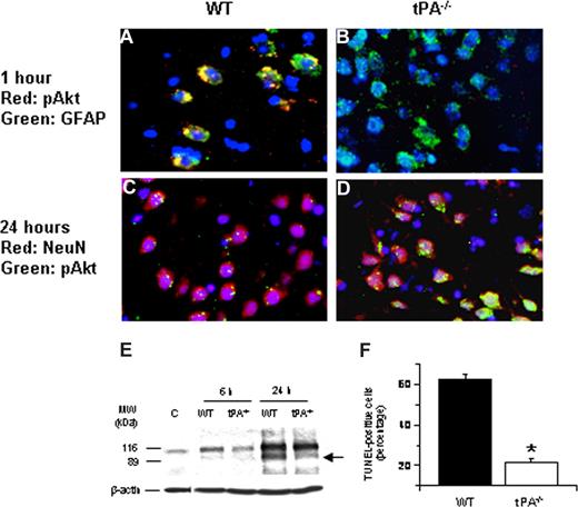 Figure 2. Effect of tPA deficiency on ischemic cell death. (A-D) Immunohistochemical analysis of neuronal pAkt in the area of interest-2 (AOI-2) 1 (A,B) and 24 (C,D) hours after middle cerebral artery occlusion (MCAO) in wild-type (A,C) and tPA−/− (B,D) mice. Blue indicates 4′,6-diamidino-2-phenylindole and red indicates pAkt in panels A and B and NeuN in panels C and D. Green indicates GFAP in panels A and B and pAkt in panels C and D. Original magnification, A-D, 40×. Images were visualized using a Leica DMRBE microscope (Leica, Houston, TX) equipped with a 100×/1.30 numeric aperture (NA) and a LeicaDC500 camera. Images were processed using software provided by the camera manufacturer. (E) Representative Western blot analysis of PARP-1 cleavage in brain extracts from wild-type (WT) and tPA−/− mice 6 and 24 hours after MCAO. C denotes a control WT animal. The arrow indicates an approximately 89-kDa PARP-1 cleavage product. Each observation was repeated 4 times. (F) Mean percentage of TUNEL-positive cells in the area of ischemic penumbra in WT and tPA−/− mice 24 hours after MCAO; n = 7. *P < .005 compared with WT mice.