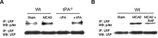 Figure 6. LRP's intracellular domain and pAkt interact in perivascular astrocytes. (A) Coimmunoprecipitation studies in brain extracts from Wt and tPA−/− mice 1 hour after MCAO. tPA−/− were either left untreated (−tPA) or injected directly into the ischemic tissue with tPA (1 μM;+tPA). (B) Coimmunoprecipitation studies in brain extracts from Wt mice 1 hour after MCAO. Animals were either left untreated (MCAO) or injected into the ischemic tissue with RAP (9 μM; MCAO + RAP).