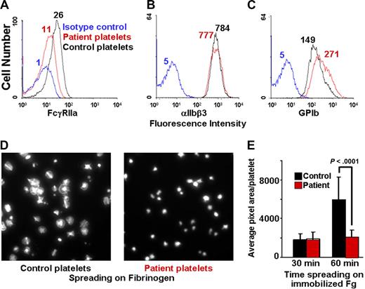 Figure 3. Human platelets expressing decreased FcγRIIa fail to spread on immobilized fibrinogen. (A-C) Flow cytometric analysis of washed platelets from a patient with an autoantibody specific for GPVI, demonstrating approximately 60% reduced expression of FcγRIIa (as reported by the binding if mAb IV.3), but normal expression of αIIbβ3 and the GPIb complex. (D,E) Washed patient platelets or control platelets from a healthy donor were allowed to spread on glass slides that had been coated with 100 μg/mL fibrinogen. The degree of platelet spreading was analyzed at both 30 and 60 minutes. Note that the patient's platelets failed to spread. Data are the mean plus or minus SEM.