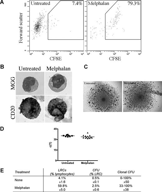 Figure 6. LRCs include drug-resistant progenitors able to generate clonotypic progeny. (A-D) Mononuclear cells were isolated from the mobilized blood preparations, labeled with CFSE, grown in 3-D for 14 days, and treated with melphalan (“Preclinical drug treatment studies”). (A) Flow cytometric profile of the LRCs. The gates for sorting were set to isolate cells with lymphocyte scatter properties (scatter plot shown is gated on the lymphocytes) and CFSEhigh fluorescence, comparable with that in the stained population preculture, as expected for nonproliferating or slowly proliferating cells. Percentage of LRCs was calculated as the percentage of CFSEhigh cells in the lymphocyte fraction of the 3-D culture. Representative FACS plots from 5 individually analyzed patients. (B) May-Grunwald-Giemsa (MGG) staining of the sorted LRCs (top) and immunohistochemical staining of sorted LRCs for CD20 (bottom; original magnification ×400); see “Immunohistochemistry.” Representative images from 3 individually analyzed patients. (C) Representative colonies from the CFU assay (original magnification 40×; n = 10 individually analyzed patients) as indicated in “Microscopy.” (D) Progeny generated from sorted LRCs from both untreated and melphalan-treated cultures were analyzed by RQ-PCR to quantify the number of clonotypic cells. These c(T) values, compared with control values, indicate that approximately 100% of the progeny were clonotypic. No RQ-PCR amplification was detectable for nonclonotypic colonies. Similar c(T) values were observed for clonotypic colonies from both treatment groups (n = 8 colonies from untreated group and n = 11 colonies from melphalan group). Horizontal lines represent medians. (E) Quantification of the LRCs as a percentage of total cells in the culture, CFU as a percentage of LRCs, and clonal CFU as a percentage of total colonies obtained in the CFU assay (mean ± SD of 8 individually analyzed patients).