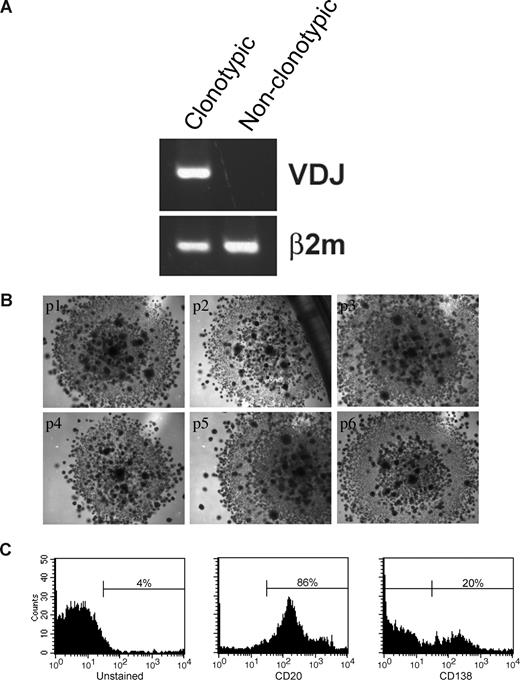 Figure 7. LRCs can be serially passaged and can generate MM plasma cells. (A) Mononuclear cells were isolated from the mobilized blood preparations, labeled with CFSE, grown in 3-D for 14 days, after which CFSEhigh lymphocytic cells were sorted from the harvested cells, and cultured in a CFU assay (no morphologic differences between clonotypic and nonclonotypic colonies were observed). Clonotypic or nonclonotypic progeny were generated from LRCs in CFU assay and tested for clonotypic IgH VDJ signatures by PCR and by RQ-PCR. Representative single-stage PCR analysis of the clonotypic IgH VDJ and β2-microglobulin from representative CFU progeny is shown; these results were confirmed using RQ-PCR (Figure 6D and data not shown). (B) LRCs were sorted and placed into CFU culture, followed by serial replating for 6 generations. Each panel is a representative image from the consecutive passage of a colony (p1) from a single patient (n = 6 patients). (C) FACS analysis of the LRC progeny after the sixth serial passage of a clonotypic colony (culture p6 from panel B). The entirety of p4 and p5 was used for clonal expansion to obtain sufficient cells for the p6 FACS analysis. Histograms are representative of those obtained for 6 different patients. All of the secondary colonies from clonotypic CFU were clonotypic. In contrast, secondary colonies from the nonclonotypic CFU were all nonclonotypic. Self-renewal capability within colonies was further supported by the morphology of the CFU arising from LRCs, which at all passages included small secondary colonies scattered throughout the primary colony, as shown in the figure.