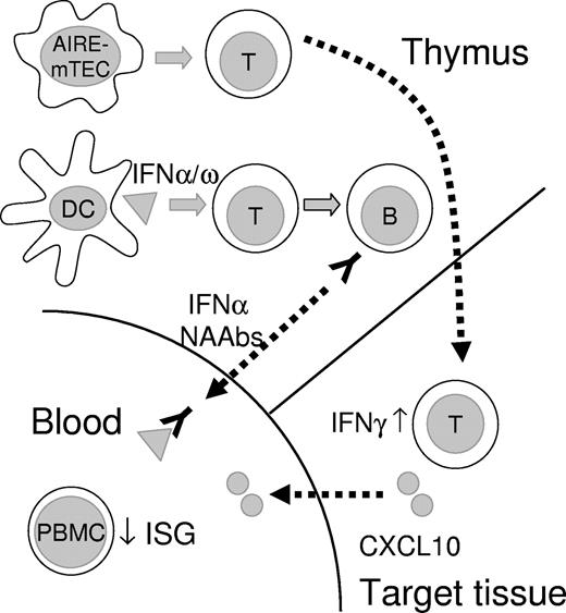 Figure 6. Schematic illustration of thymic and peripheral events in APECED. Tissue-restricted antigen-specific T cells are not deleted in APECED thymus because of the deficient function of AIRE in medullary thymic epithelial cells (mTEC), and escape to cause tissue damage in endocrine organs in APECED patients. We speculate that, because of aberrant cell death or alternative danger signal, human AIRE-deficient thymus (and thymomas) assume some functions of secondary lymphoid organs, with associated overproduction of type I IFNs by thymic DCs. These DCs are activated and present a broad spectrum of type I interferons to autoimmunize specific T and then B cells. The resulting high titer neutralizing antibodies inhibit ISG responses of PBMCs to basal circulating levels of type I IFNs. Autoreactive T cells infiltrating target endocrine tissues secrete IFN-γ. This induces the production of CXCL10 and further expansion of the adjacent infiltrates.