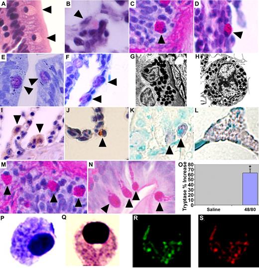 Figure 1. Zebrafish MCs structurally and functionally resemble their mammalian counterparts. H&E staining. (A) Intestine. (B) Gill. Periodic acid-Schiff (PAS). (C) Intestine. (D) Gill. Toluidine blue. (E) Intestine. (F) Gill. MCs in each panel indicated by ▶. Transmission electron microscope (Phillips 300; FEI, Hillsboro, OR) images of (G) a zebrafish intestinal MC (20 000× magnification) and (H) a mouse bone marrow–derived MC (26 000× magnification). Zebrafish MCs demonstrate a positive reaction to (I) a polyclonal antibody raised against human CD117 (C-KIT) antigen (Dako Cytomation, Carpinteria, CA) and (J) a monoclonal anti–human MC tryptase antibody (gills; Dako Cytomation). Biotinylated Universal Linker (Dako Cytomation) secondary antibody and 3,3′-diaminobenzidine for chromogenic detection (hematoxylin counterstain; 100× objective). RNA ISH using digoxigenin-labeled RNA antisense probe to zebrafish cpa5 demonstrates positive staining in (K) intestinal MCs and (L) pancreas; MCs indicated by ▶. Adult zebrafish injected intraperitoneally with 10 μg of compound 48/80 demonstrate (N) MC degranulation compared with (M) saline-injected controls. PAS staining, 100× objective; MCs in each panel indicated by ▶. (O) Increased plasma tryptase levels compared with saline-injected control fish. Presented as means plus SEM of 3 experiments with 4 to 6 fish per group; *P < .05 (t test). Cytospin of FACS-sorted, FITC-labeled, Fast Red–stained cpa5+ cells isolated from zebrafish embryos at 7 dpf demonstrate morphology consistent with MCs. (P) Toluidine blue. (Q) Wright-Giemsa. (R) Green channel (FITC). (S) Red channel (Fast Red; also Figure S2). (A-F, I-N) Images obtained at 100×/1.3 NA oil-immersion objective with a Nikon Eclipse E600, Nikon DXM 1200 camera, and ACT-1 software (all Nikon, Tokyo, Japan). Panels assembled using Adobe Photoshop CS3 Extended version 10.0 (Adobe Systems, San Jose, CA). (P-S) Images obtained at 100×/1.4 NA oil immersion objective with a Zeiss Axioplan 2 (Zeiss, Jena, Germany) and Axiocam HRc digital camera, Axiovision 4.6 with multi-channel fluorescence module (Diagnostic Instruments, Sterling Heights, MI).