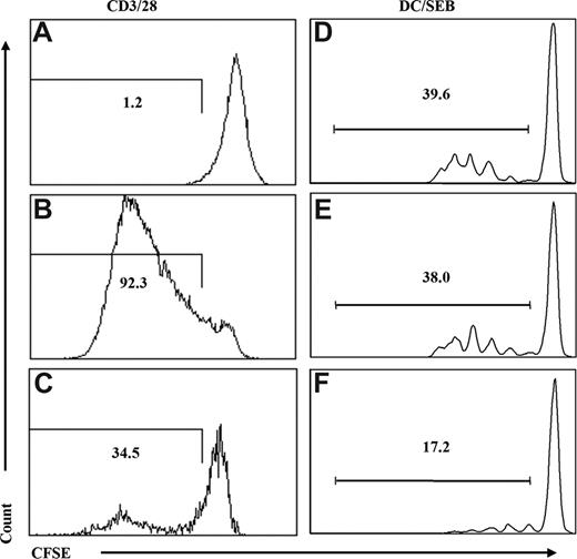 Figure 2. Human CD3+CD4+CD25+ T cells from DKO-hu HSC mice are functional Treg cells. Human Treg cells (huCD45+CD3+CD4+CD25+) from DKO-hu HSC mice were isolated by FACS (> 95% purity), and cocultured with naive CD4+CD25− T cells from human PBMCs labeled with CFSE. Cells were activated either with antihuman CD3/CD28 mAb (A-C) or with mDCs pulsed with SEB (10 pg/mL; D-F). At 4 to 5 days after activation, cells were analyzed for CFSE levels by flow cytometry. Numbers indicate percentage of CFSElow (proliferated) responder cells. (A) CFSE-labeled responder cells without CD3/CD28 stimulation. (B) CFSE-labeled responder cells with CD3/CD28 stimulation.(C) Treg cells plus CFSE-labeled responder cells (at a 1:2 Treg/responder ratio) with CD3/CD28 stimulation. (D) CFSE-labeled responder cells with SEB-pulsed mDCs. (E) CFSE-labeled responder cells and SEB-pulsed mDCs plus CD4+CD25− naive T cells isolated from DKO-hu mice. (F) CFSE-labeled responder cells and SEB-pulsed mDCs plus CD4+CD25+ Treg cells. Both CD4+CD25− control and CD4+CD25+ Treg cells were used at 1:1 ratio relative to responder cells. Data shown are representative of 2 independent experiments.