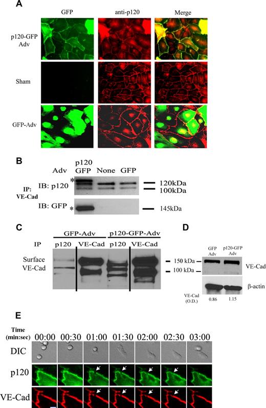 Figure 1. Characterization of p120 expression in vascular endothelium and p120GFP/VE-cad gap formation during leukocyte TEM at the endothelial cell junctions. Confluent HUVECs were transduced with GFP or p120GFP adenovirues as described in “Adenovirus production and cell infection.” (A) p120GFP colocalizes with endogenous p120 at cell junctions. Monolayers were transduced with p120GFP, or sham treated, fixed with 10% buffered formalin, permeabilized, and stained with anti-p120 mAb. Representative fields were examined by epifluorescence microscopy and show junctional distribution of p120GFP and colocalization with endogenous p120 at cell junctions. (B) VE-cad was immunoprecipitated from the HUVEC lysates, and the material was immunoblotted for p120 to show endogenous isoforms of p120/p100, or with an anti-GFP mAb to detect expression of p120GFP. (C) HUVECs were surface biotinylated, lysed, and subjected to immunoprecipitation with anti-p120 mAb, or VE-cad mAb. The association of p120GFP with VE-cad was detected with streptavidin-peroxidase. Vertical lines have been inserted to indicate a repositioned gel lane. (D) Transduced HUVECs were lysed directly and blotted with Hec-1 to detect total VE-cad. Normalized VE-cad values versus β-actin are shown by OD numbers. Data are representative of 3 separate studies. (E) Three-channel live-time microscopy of PMNs in the process of transmigration. Paired 2-color fluorescence of VE-cad Alexa 568–stained HUVECs (red channel), p120GFP low-dose infected HUVECs (green channel), and simultaneous DIC images are presented. At t = 0, PMN approaches the brightly stained cell junction. At t = 1:00, PMN starts to transmigrate and a de novo gap is detected. At t = 3:00, the gap is sealed. This gap in p120-catenin GFP colocalized with the gap formed by VE-cadherin (red) during transmigration, as demonstrated in the merge panel. Bar represents 10 μm. The figure represents a typical sequence of events during PMN TEM. Five independent experiments using HUVECs and PMNs from multiple donors were analyzed.