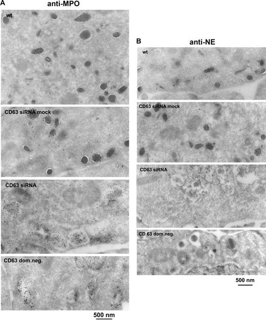 Figure 7. CD63-depleted HL-60 cells show a lack of morphologically normal granules and contain MPO-positive cytoplasmic vacuoles lacking NE—immunoelectron microscopy. Wild-type (wt), CD63 siRNA mock, CD63 siRNA, and CD63 dom neg HL-60 cells were examined. Ultrathin cryosections were labeled (A) with rabbit anti-MPO (10-nm gold) or (B) with rabbit anti-NE (10-nm gold). The CD63-depleted cells lacked normal granules and contained more vacuoles. MPO labeling was localized both to the granules of the wild-type and mock cells and to the vacuoles of CD63 siRNA and CD63 dom neg cells. NE labeling was seen in granules of wild-type and mock cells. Table 1 shows the NE-positive fraction of MPO-positive vacuoles/granules, obtained by counting gold particles in cell sections from 100 different cells of a CD63 siRNA clone and a CD63 dom neg clone. A lack of NE labeling was observed in 70% to 80% of the cytoplasmic vacuoles/granules of CD63 siRNA and CD63 dom neg cells. Labeling was sometimes observed on the Golgi (G) and trans-Golgi network (TGN) of CD63-depleted cells. Scrambled siRNA controls are shown in Figure S2F.