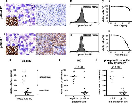 Figure 4. Akt is activated in a subset of primary MM samples and this determines their vulnerability to pharmacologic Akt inhibition. (A-C) IHC, phospho-Akt–specific flow cytometry, and susceptibility to pharmacologic Akt inhibition in 2 exemplary primary MM samples. (Ai,ii) Immunohistochemical detection of phospho-Akt in bone marrow biopsies heavily infiltrated by MM cells (right panels). Giemsa stained overview and IHC staining for plasma-cell marker CD138 (inset) shown to the left. Original magnifications, 400× (left) and 200× (right and insets). (Bi,ii) Phospho-Akt–specific flow cytometry in freshly purified CD138+ MM cells from the same patients as in panel A. A total of 50 000 cells per well were kept for a total of 24 hours in medium alone. They were then treated overnight with Akti-1/2 (10 μM) or DMSO. (Ci,ii) Viability of freshly purified CD138+ MM cells from the same patients as in panels A and B after treatment with Akti-1/2 for 5 days. Cells were cocultured with BMSCs and survival was determined by annexin V–FITC/PI staining and flow cytometry. The percentage of viable cells reflects comparison to DMSO-treated controls. Of note, whereas the Akti-1/2 resistant sample (patient 17) did not display Akt phosphorylation, the Akti-1/2–sensitive case (patient 6) showed strong phospho-Akt signals. (D) Effect plot of all primary MM samples tested (n = 30) for their susceptibility to treatment with 10 μM Akti-1/2. Viability determined as described in panel C. The medians for the strongly sensitive and the more resilient/resistant groups are indicated. (E) Correlation of Akt activation in BM biopsies with viability of MM cells from the corresponding patient after treatment with Akti-1/2 (n = 19). Viability was determined as described in panel C. (F) Correlation of the fold change in MFI for phospho-Akt in primary MM cells with their viability after treatment with Akti-1/2 (n = 20). Measurements performed as described in panels B and C. Horizontal bars mark the medians.