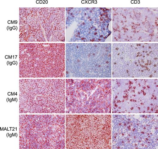 Figure 1. IgG expressing PCMZLs do not express CXCR3. Frozen sections of CM09, CM17, CM04, and MALT21 stained with monoclonal antibodies (in red, 3-amino-9-ethylcarbazole) specific for CD20, CXCR3, and CD3 (original magnification × 400) and counterstained with hematoxylin. IgG-expressing PCMZLs CM09 and CM17 contain CXCR3+ T cells, whereas the neoplastic B cells in these tissues are CXCR3−. In contrast, CM04, an IgM-expressing PCMZL, is positive for CXCR3, like the salivary gland MZBCL “MALT21.”